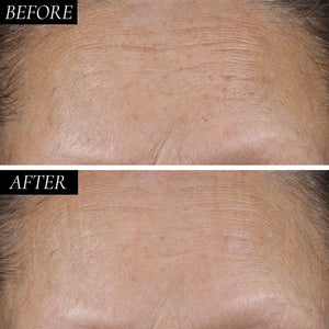 Diamond Contour 1 Minute Skin Tightening Retinol Concentrate