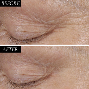 Diamond Contour 1 Minute Skin Tightening Retinol Concentrate