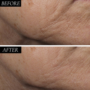 Diamond Contour 1 Minute Skin Tightening Retinol Concentrate